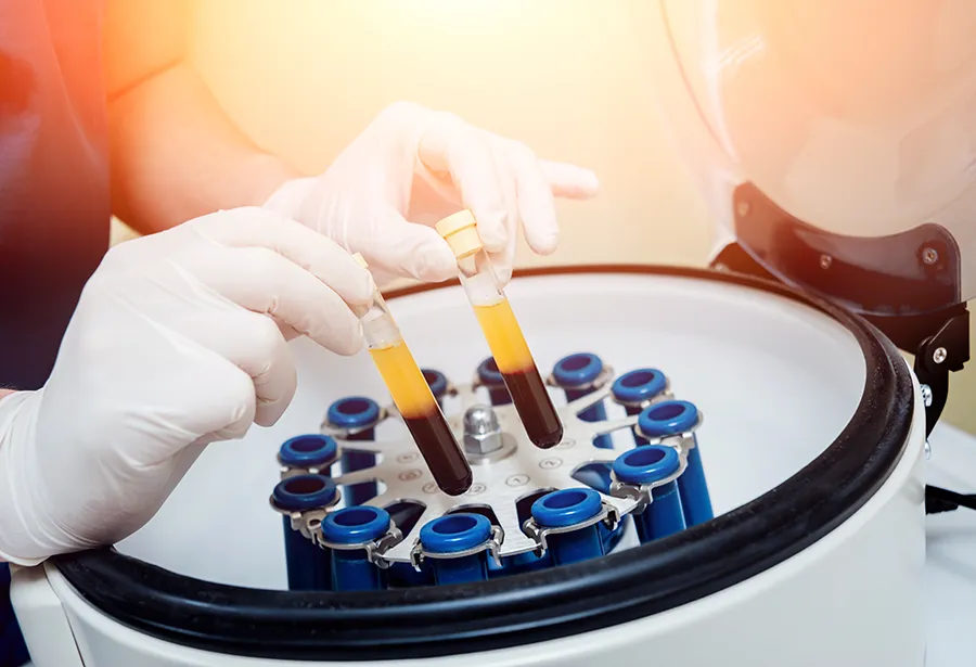 Blood sample tubes in centrifuge used to prepare platelet rich plasma for PRP injection procedure